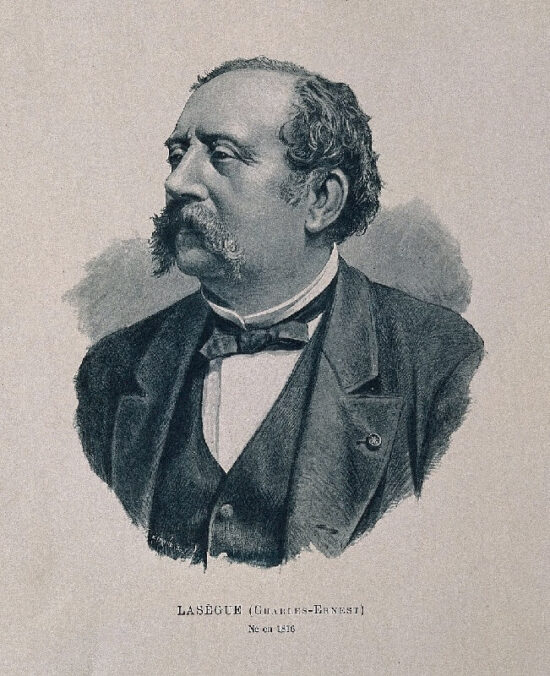 Ernest-Charles Lasegue