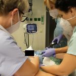 Metoda Stretta v Plzni