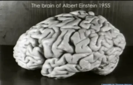 Einsteinův mozek